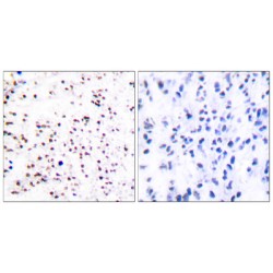 Minichromosome Maintenance Deficient 5 (MCM5) Antibody