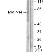 Western blot analysis of extracts from NIH/3T3 cells, using MMP-14 antibody (abx013143).