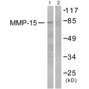 Western blot analysis of extracts from MDA-MB-435 cells, using MMP-15 antibody (abx013144).