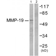 Western blot analysis of extracts from HepG2 cells, using MMP-16 antibody (abx013145).