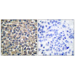 Matrix Metalloproteinase-19 (MMP-19) Antibody