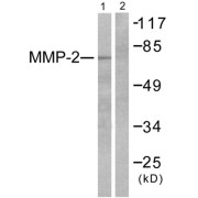 Western blot analysis of extracts from LOVO cells, using MMP2 antibody (abx013147).