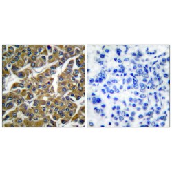 Matrix Metalloproteinase 3 / Stromelysin-1 (MMP3) Antibody