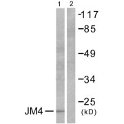 Western blot analysis of extracts from LOVO cells, using JM4 antibody (abx013118).