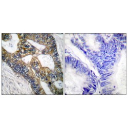 Matrilysin (MMP7) Antibody