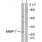 Western blot analysis of extracts from COS7 cells, using MMP7 antibody (abx013150).