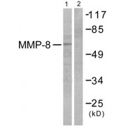 Western blot analysis of extracts from NIH/3T3 cells, using MMP8 antibody (abx013151).