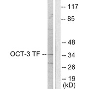 Western blot analysis of extracts from HeLa cells, using OCT3 antibody (abx013160).