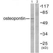 Western blot analysis of extracts from LOVO cells, using osteopontin antibody (abx013161).