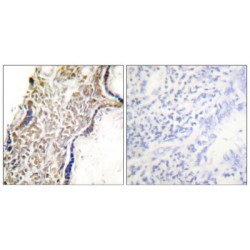 Tumor Suppressor ARF (CDKN2A) Antibody