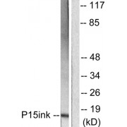 Western blot analysis of extracts from HeLa cells, using p15 INK antibody (abx013163).