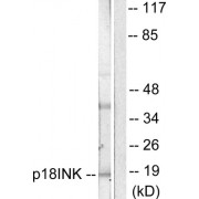 Western blot analysis of extracts from COS7 cells, using p18 INK antibody (abx013164).