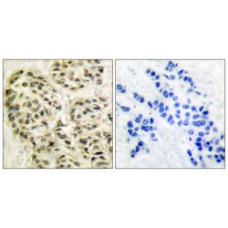 Cyclin L1 (CCNL1) Antibody