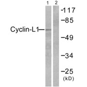 Western blot analysis of extracts from HepG2 cells, using Cyclin-L1 antibody (abx013171).