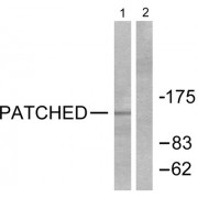 Western blot analysis of extracts from mouse muscle cells, using Patched antibody (abx013172).