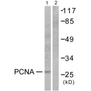 Western blot analysis of extracts from HepG2 cells, using PCNA antibody (abx013174).