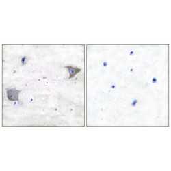 Platelet Derived Growth Factor Receptor Alpha (PDGFRA) Antibody