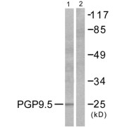 Western blot analysis of extracts from 293 cells, using PGP9.5/UCHL1 antibody. The lane on the right is blocked with the synthesized peptide.