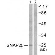 Western blot analysis of extracts from RAW264.7 cells, treated with EGF (200ng/ml, 30mins), using SNAP25 antibody (abx013194).