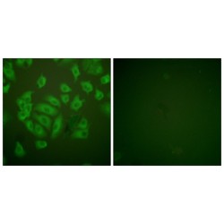 Stefin A (STFA) Antibody