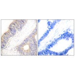 Stefin A (STFA) Antibody