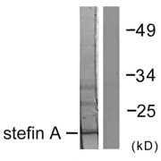Western blot analysis of extracts from A549 cells, using Stefin A antibody.