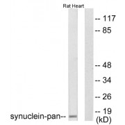 Western blot analysis of extracts from rat heart, using Synuclein-pan Antibody.