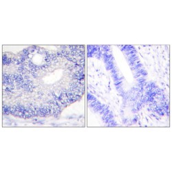 Transforming Growth Factor Alpha (TGFA) Antibody