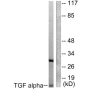 Western blot analysis of extracts from COS7 cells, using TGF alpha antibody (abx013207).