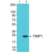 Western blot analysis of extracts from cos-7 cells (Lane 2), using TIMP1 Antibody. The lane on the left is treated with synthesized peptide.