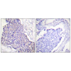 TNF Receptor Superfamily Member 5 / TNFRSF5 (CD40) Antibody
