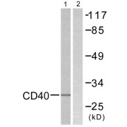 abx013215