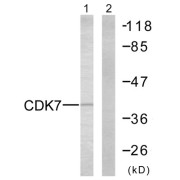 Western blot analysis of extracts from 293 cells, using CDK7 antibody.