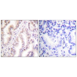 Protein Inhibitor of Activated STAT 1 (PIAS1) Antibody