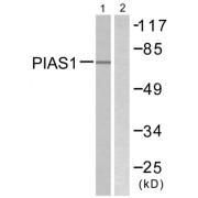Western blot analysis of extracts from MDA-MB-435 cells, using PIAS1 antibody. The right lane is blocked with peptide.