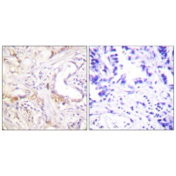 Protein Inhibitor of Activated STAT3 (PIAS3) Antibody
