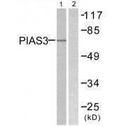Western blot analysis of extracts from 293 cells, treated with UV (5mins), using PIAS3 antibody.