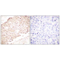 SUMO1/Sentrin Specific Peptidase 1 (SENP1) Antibody