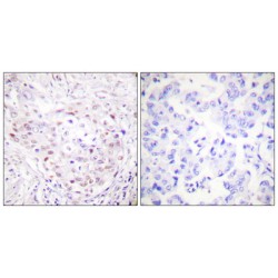 SUMO1/Sentrin/SMT3 Specific Peptidase 3 (SENP3) Antibody