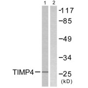 Western blot analysis of extracts from NIH/3T3 cells, using TIMP4 antibody.