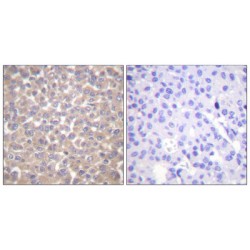 Tumor Necrosis Factor Receptor Type 1-Associated DEATH Domain Protein (TRADD) Antibody