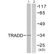abx013237