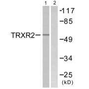 Western blot analysis of extracts from HT29 cells, using TRXR2 antibody.