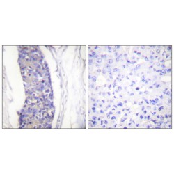 Tubulin Alpha (TUBA) Antibody
