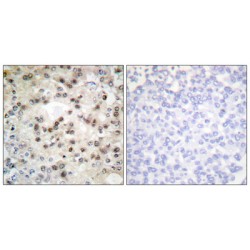 Upstream Stimulatory Factor 2 (USF2) Antibody