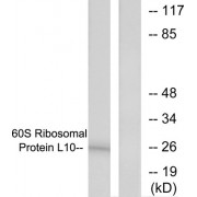 Western blot analysis of extracts from K562 cells, treated with Insulin (0.01u/ml, 15mins), using 60S Ribosomal Protein L10 antibody.