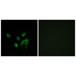 Proto-Oncogene Wnt-1 (WNT1) Antibody