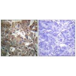 DNA Repair Protein Complementing XP-A Cells (XPA) Antibody