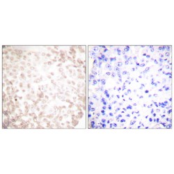X-Ray Repair Cross Complementing 1 (XRCC1) Antibody