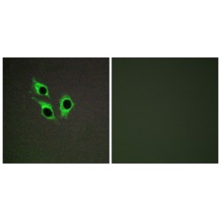 Transmembrane Protein 16J (TM16J) Antibody